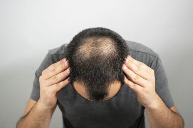 Find out how GHK-Cu peptide for hair can help men, today. Read the blog by PracticeRX concierge doctors in Scottsdale, Arizona
